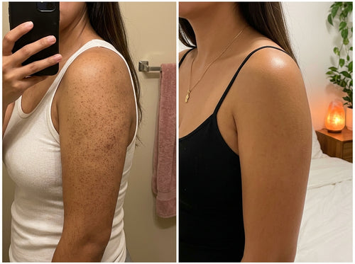 Fresia™ | Crema Triple Ácido para piel de fresa