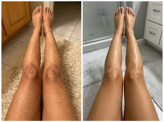 Piernas antes y después