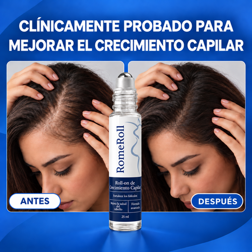 RomeRoll™ | Roll-on capilar anticaída