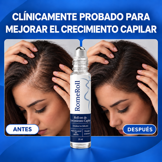 RomeRoll™ | Roll-on capilar anticaída