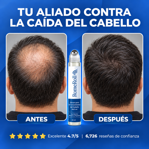 RomeRoll™ | Roll-on capilar anticaída