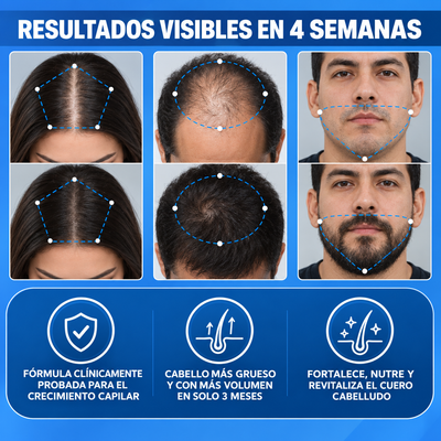 RomeRoll™ | Roll-on capilar anticaída