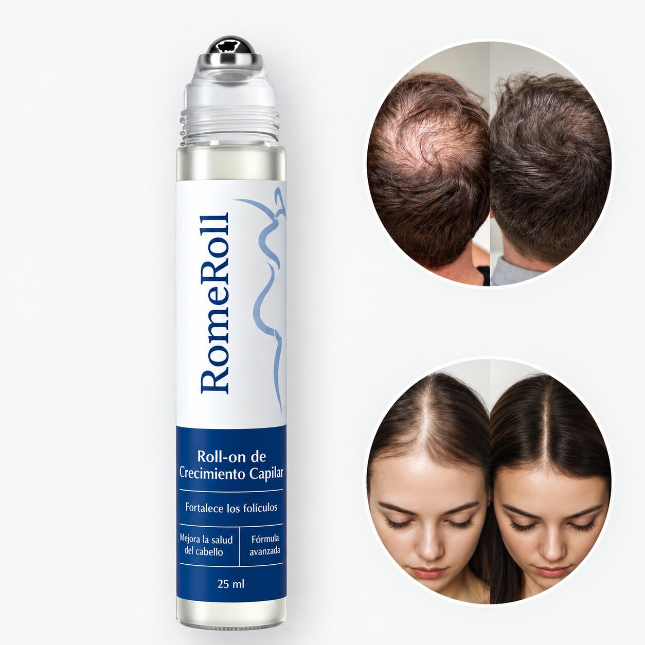 RomeRoll™ roll-on capilar